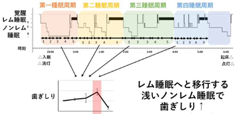 歯軋りチェッカー